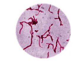 Leptospira interrogans qPCR